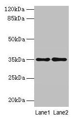 SDSL Antibody