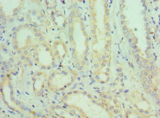 SEMG1 Antibody