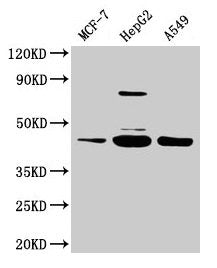 SERPINB1 Antibody
