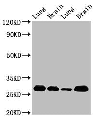 SFN Antibody