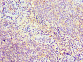 SRSF4 Antibody