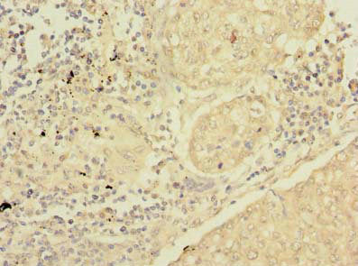 SFTPC Antibody