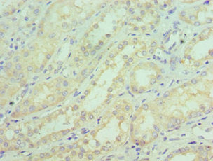 SGTA Antibody
