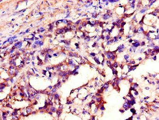 SH2D1A Antibody