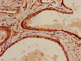 SHC1 Antibody