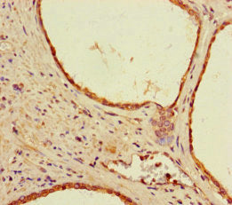 SEM1 Antibody