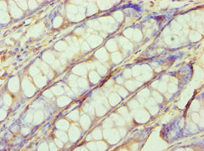 SHMT1 Antibody