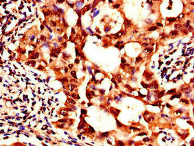 SIK1 Antibody