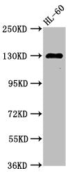 SIPA1 Antibody