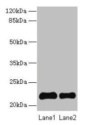 SIRPD Antibody