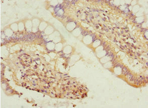 SIVA1 Antibody