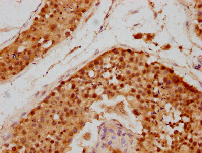 SIVA1 Antibody