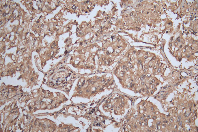 SLAMF7 Antibody