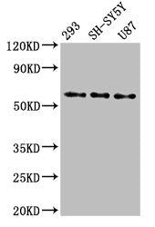SLC11A2 Antibody