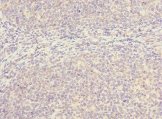 SLC17A3 Antibody