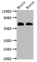 SLC1A2 Antibody