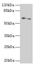 SLC1A6 Antibody
