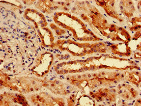 SLC25A1 Antibody