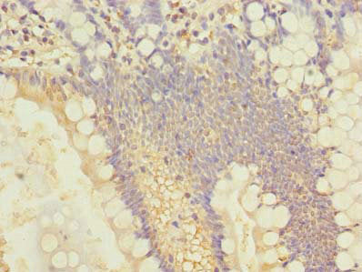 SLC25A4 Antibody