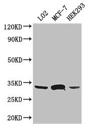 SLC25A6 Antibody