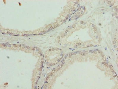 SLC31A2 Antibody