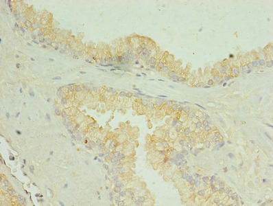 SLC34A2 Antibody