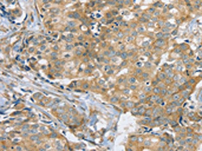 SLC9A3R2 Antibody