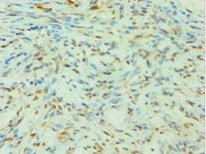 SLC4A2 Antibody