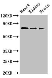SLC5A1 Antibody