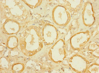 SLC5A2 Antibody