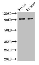 SLC9A1 Antibody