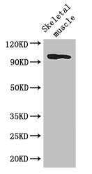 SLFN11 Antibody
