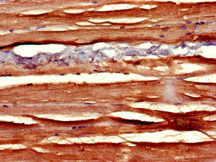 SLIT3 Antibody