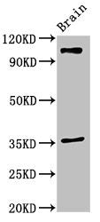 SLITRK5 Antibody