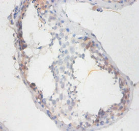 SMCP Antibody