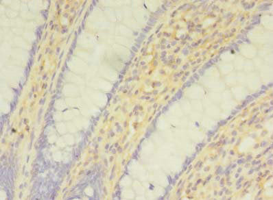SNAI1 Antibody