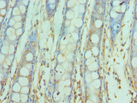 SNAP25 Antibody