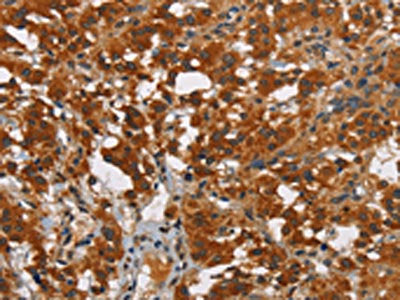 SMAD9 Antibody