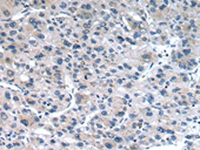 CLDN19 Antibody