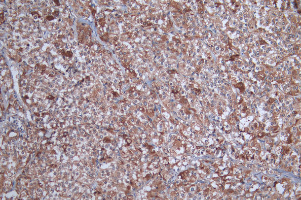 SOAT1 Antibody