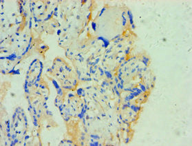 SOAT1 Antibody