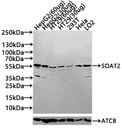 SOAT2 Antibody