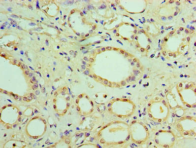SOCS1 Antibody