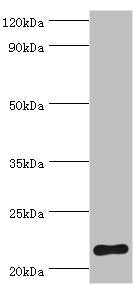 SOCS2 Antibody