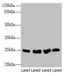 Socs3 Antibody