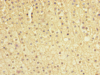 SOCS5 Antibody