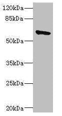 SOCS5 Antibody
