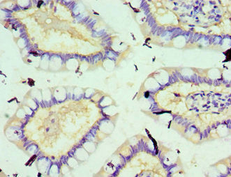 SOD3 Antibody