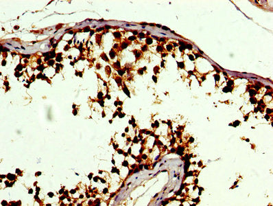 SOD3 Antibody