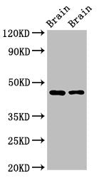 SOX11 Antibody